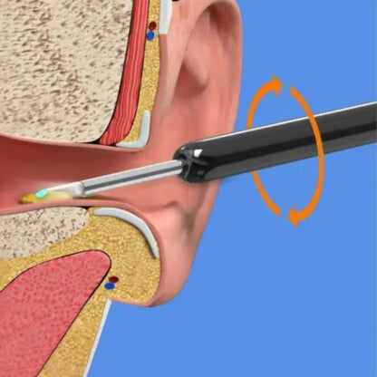 EarClear - Trådlöst öronvaxborttagningsverktyg med otoskop